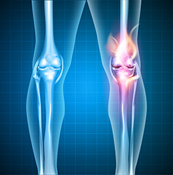 bones and joints