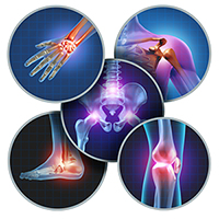 The role of joints