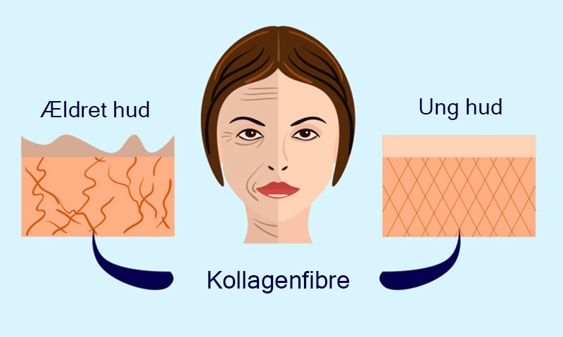 Representation of Collagen Fibers in Aged & Young Skin
