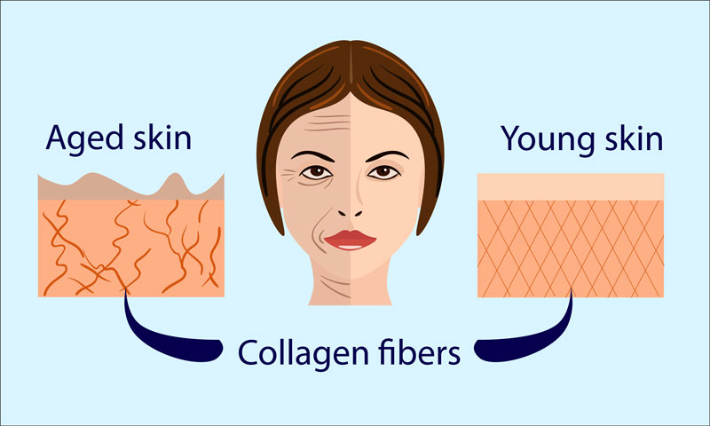 Representation of Collagen Fibers in Aged & Young Skin