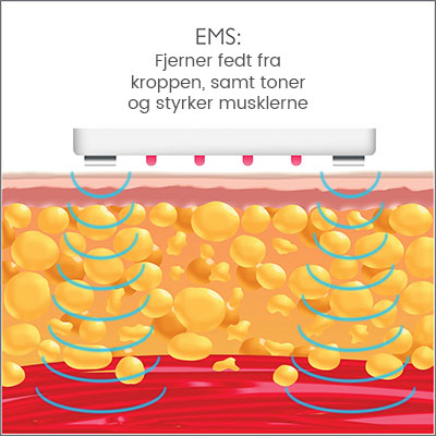 EMS-teknologi silk'n lipo EMS-teknologi silk'n lipo